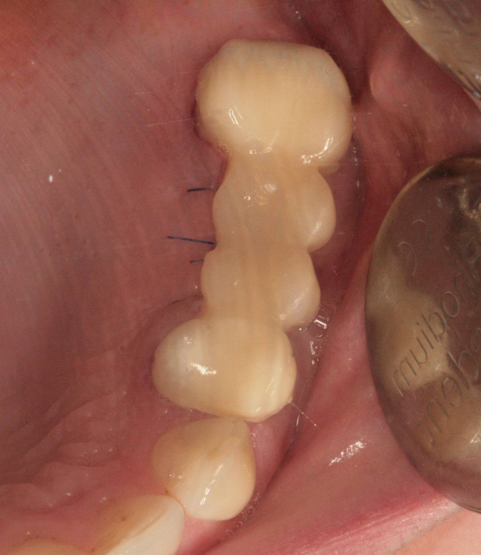 Eier2